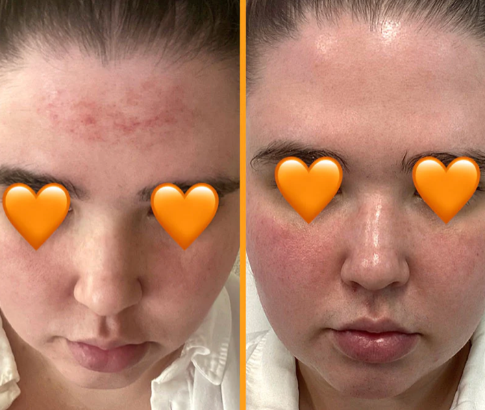 HAIRtamin SKINTAMIN : 1 MONTH SUPPLY : strongly supports skin firmness and elasticity and help reduce blemishes & breakouts, WITH ORIGINAL HOLOGRAM
