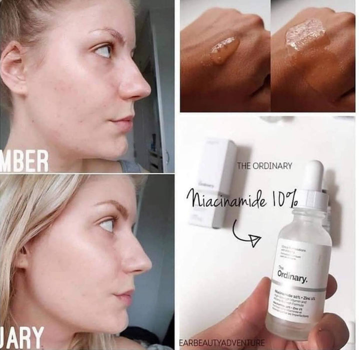 The ordinary niacinamide serum the ordinary - Achieve enchanting skin and face results with this duo and magic product