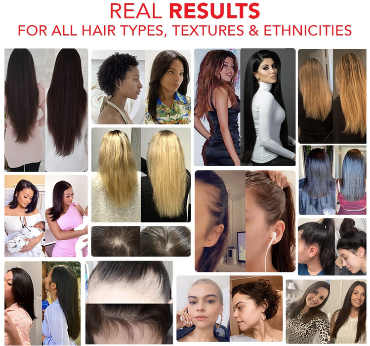 HAIRTAMIN GUMMY STARS - Hairtamin for women Original USA supplied by MIGILAN official Hairtamin distributor