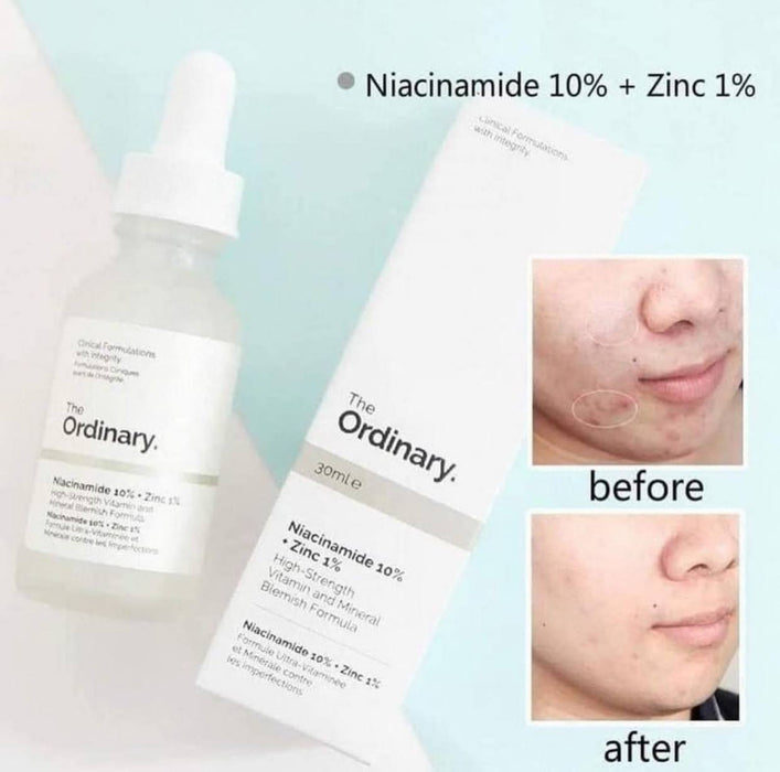 3 The ordinary niacinamide serum the ordinary WITH ORIGINAL HOLOGRAM - Achieve enchanting skin and face results with this duo and magic product